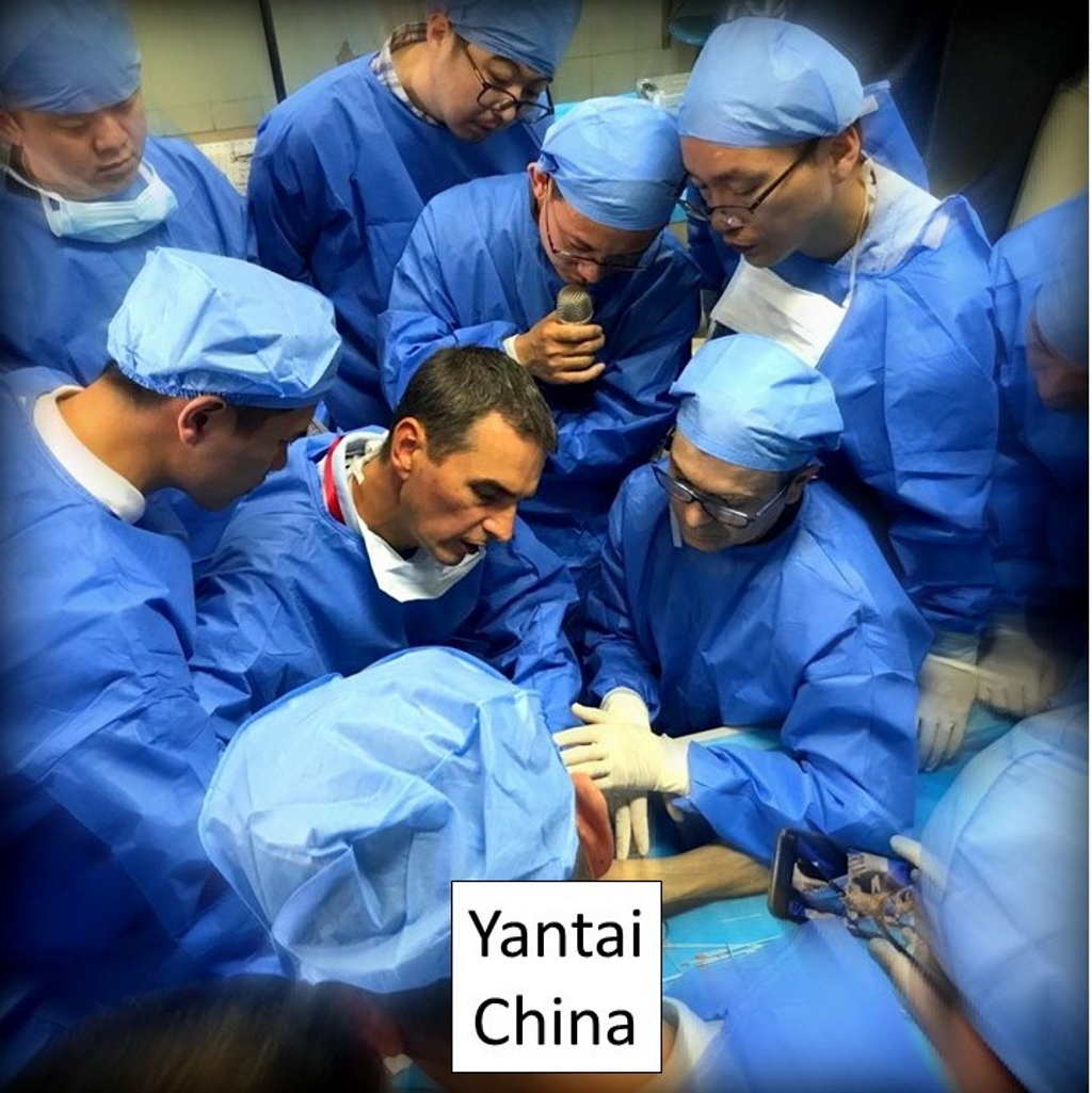Ο Ορθοπαιδικός Χειρουργός Παναγιώτης Συμεωνίδης κατά την διάρκεια εκπαιδευτικού σεμιναρίου με νεκροτομικά παρασκευάσματα στην πόλη Yantai της Κίνας
